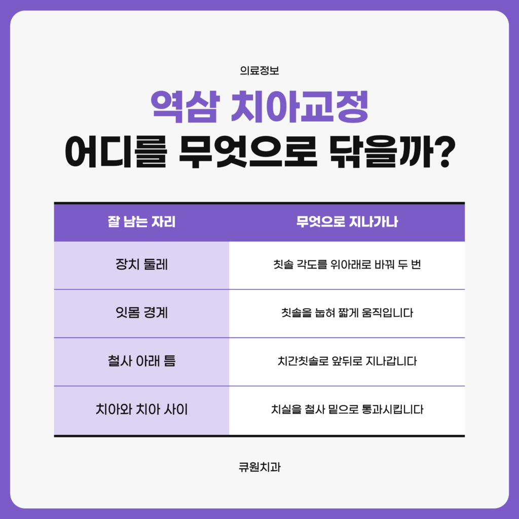 역삼 치아교정 중에 남기 쉬운 장치 둘레와 잇몸 경계, 철사 아래, 치아 사이를 도구별로 갈라 정리한 큐원치과 자료 도표